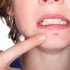 Five Reasons Why The Raw Food Diet Is Recognized To Cure Acne